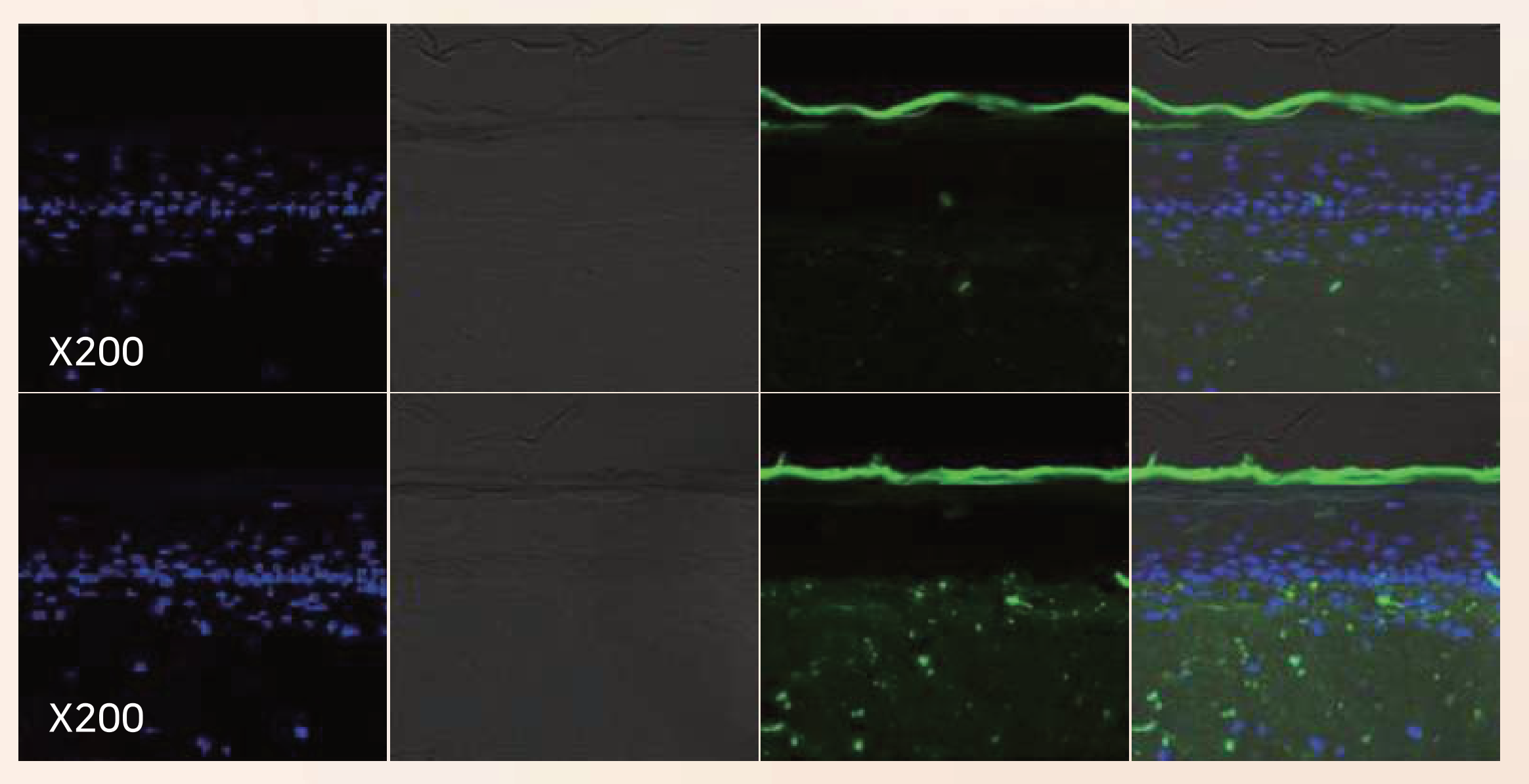 EGF confocal observation