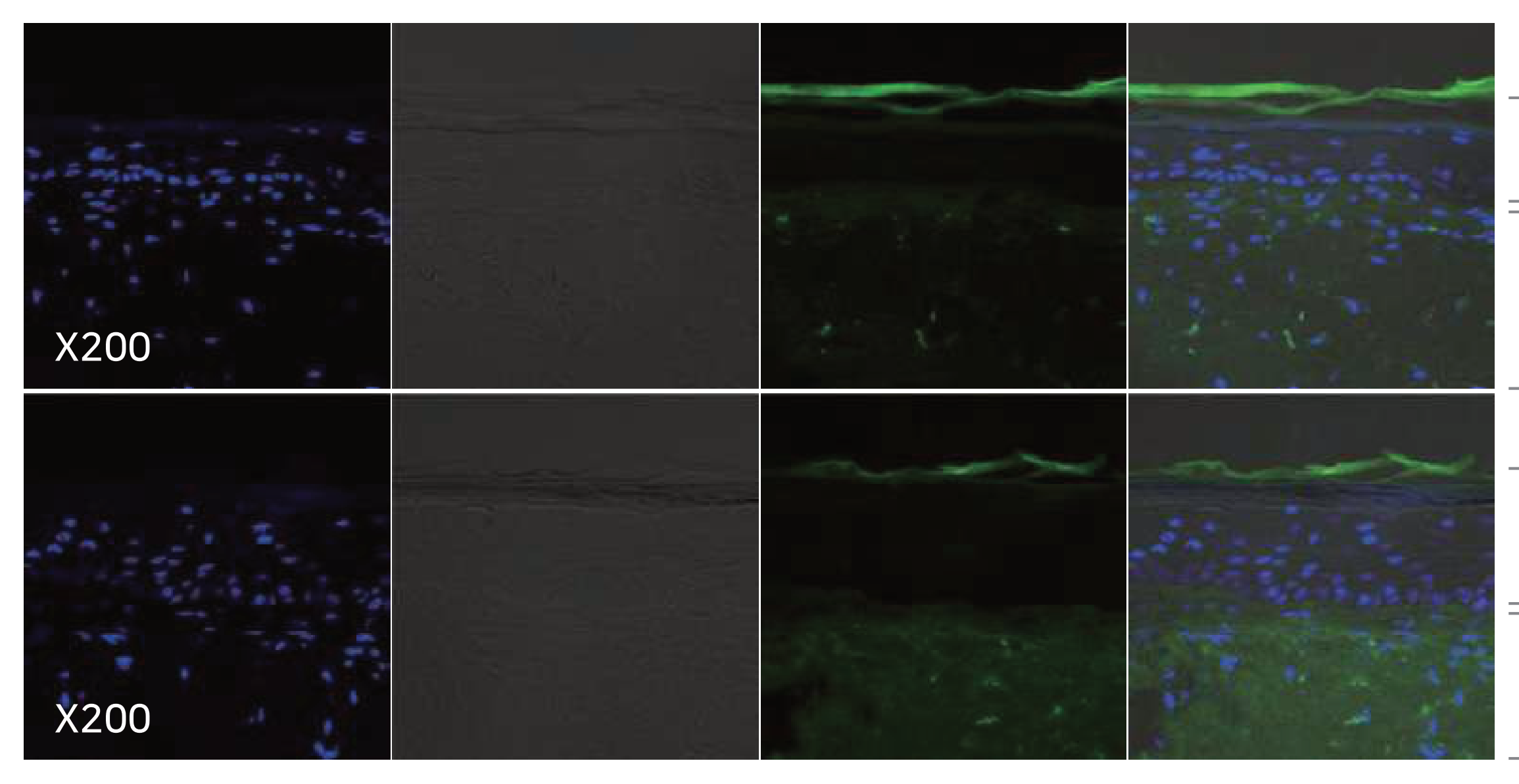 SOD1 confocal observation
